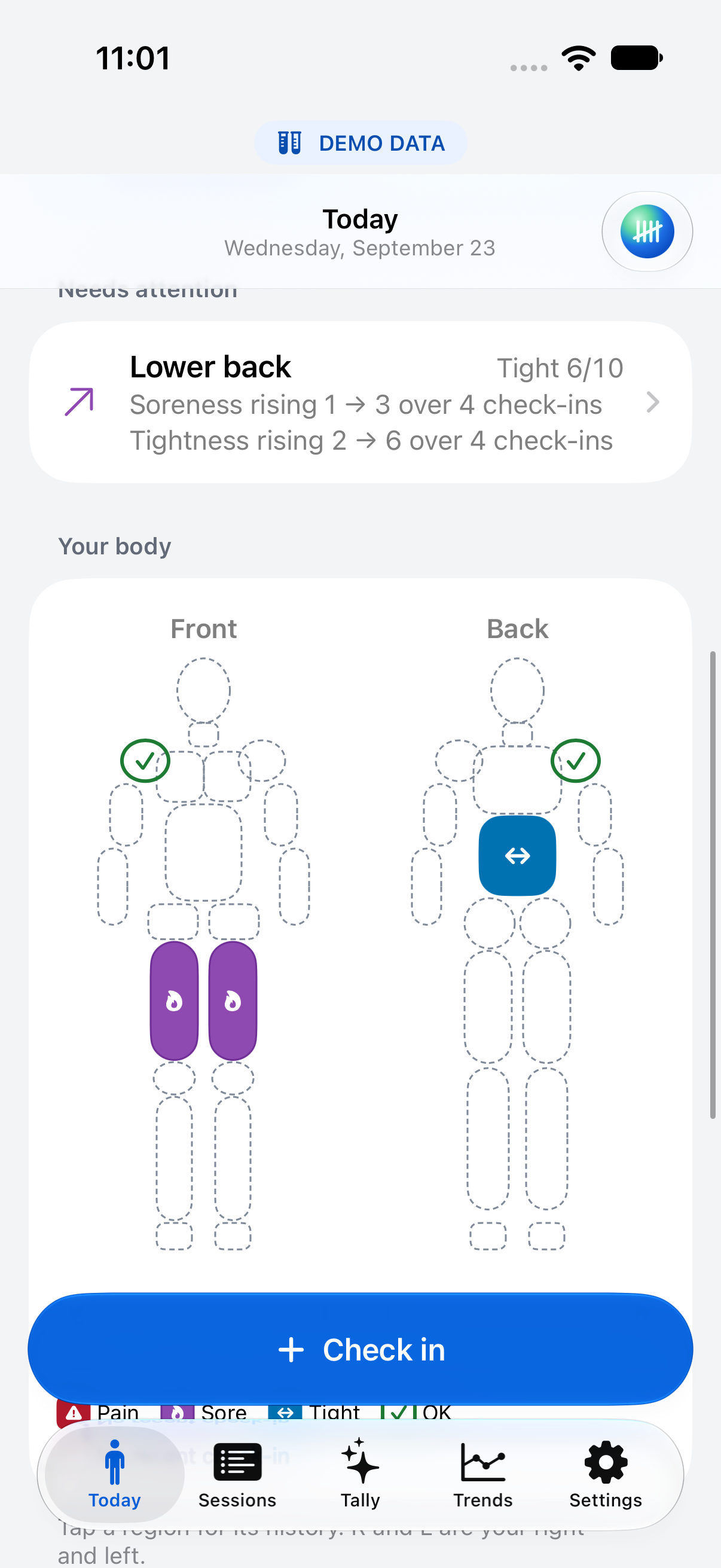 Demo body map with labeled front and back figures and condition indicators for body regions.